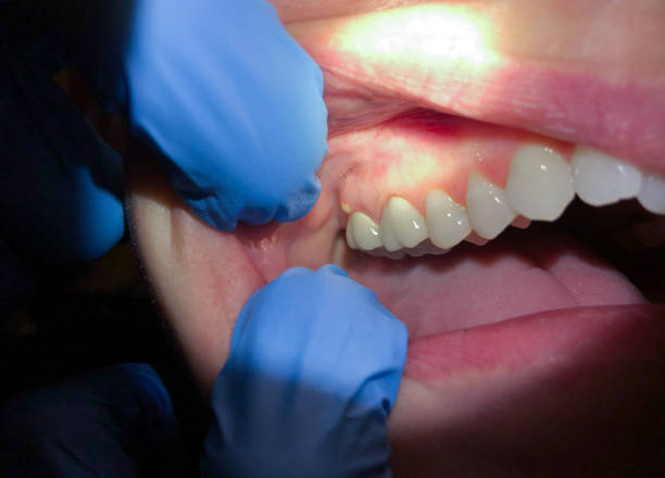Best Weekend Emergency Dentist in Bonduel, WI